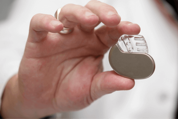 Permanent Pacemaker Implantation, Dual Chamber & BIV Pacing